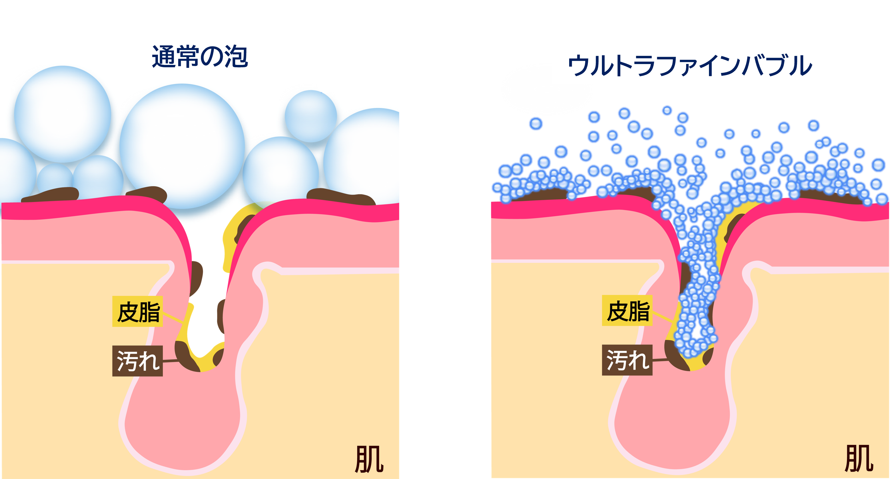 お肌とウルトラファインバブル、通常の泡のイメージ図